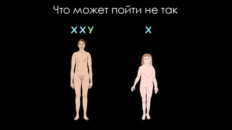 Что может пойти не так XXY X 