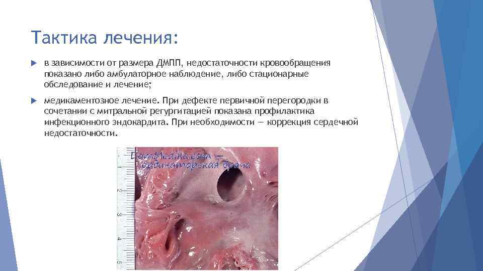 Тактика лечения: в зависимости от размера ДМПП, недостаточности кровообращения показано либо амбулаторное наблюдение, либо