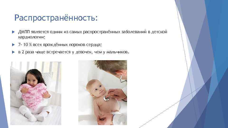 Распространённость: ДМПП является одним из самых распространённых заболеваний в детской кардиологии; 7 - 10