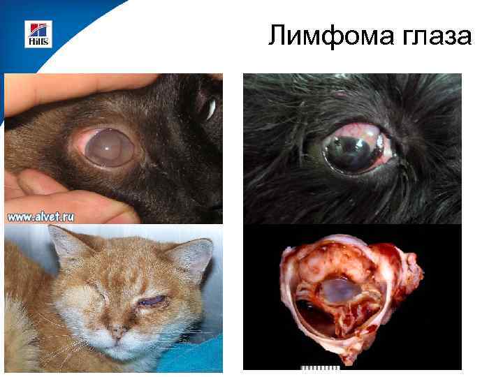 Лимфома глаза 