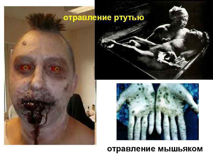 отравление ртутью отравление мышьяком 
