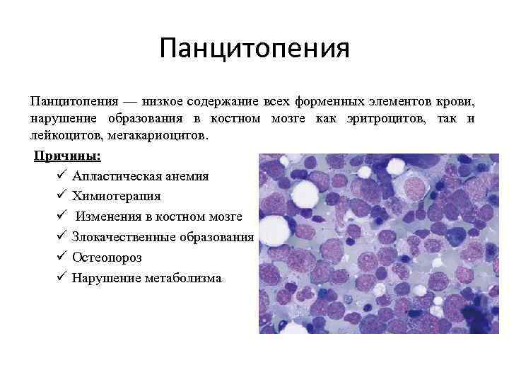 Панцитопения — низкое содержание всех форменных элементов крови, нарушение образования в костном мозге как