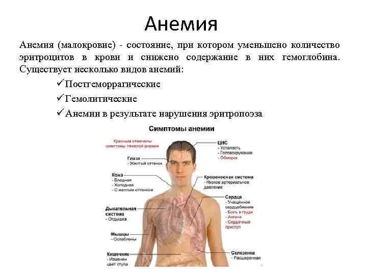 Анемия (малокровие) - состояние, при котором уменьшено количество эритроцитов в крови и снижено содержание