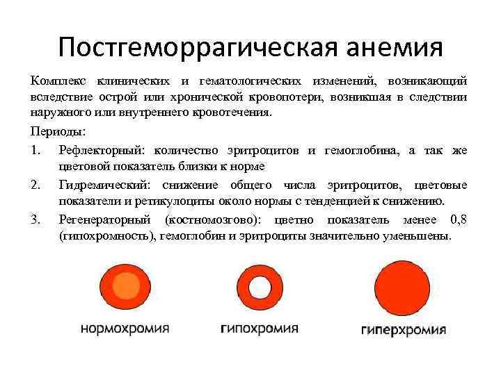 Постгеморрагическая анемия Комплекс клинических и гематологических изменений, возникающий вследствие острой или хронической кровопотери, возникшая