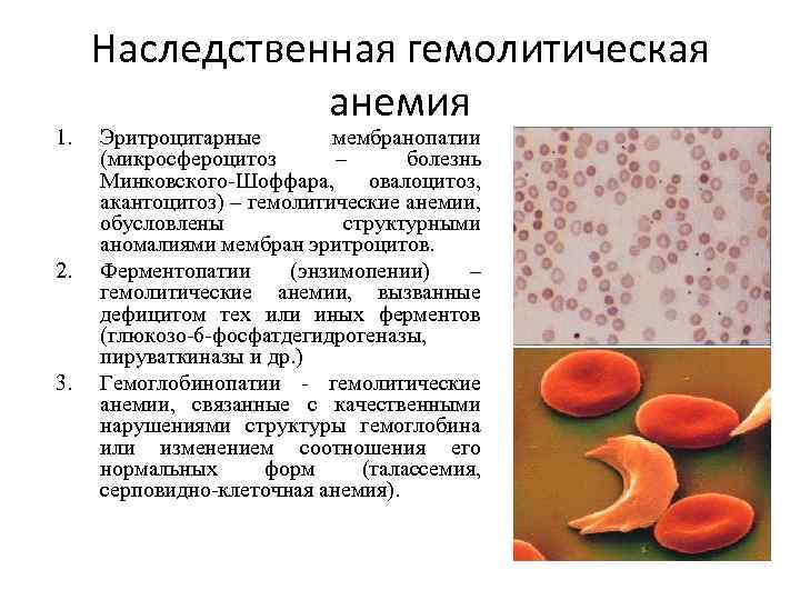 1. 2. 3. Наследственная гемолитическая анемия Эритроцитарные мембранопатии (микросфероцитоз – болезнь Минковского-Шоффара, овалоцитоз, акантоцитоз)