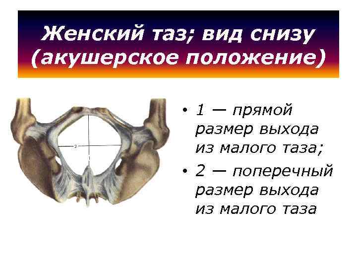 Женский таз; вид снизу (акушерское положение) • 1 — прямой размер выхода из малого