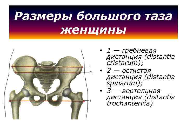 Размеры большого таза женщины • 1 — гребневая дистанция (distantia cristarum); • 2 —