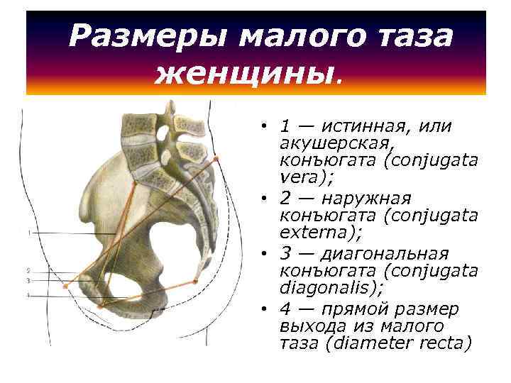  Размеры малого таза женщины. • 1 — истинная, или акушерская, конъюгата (conjugata vera);