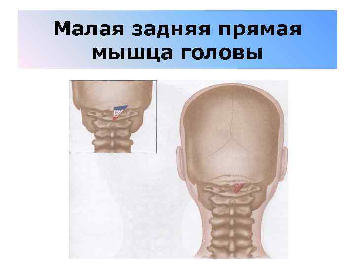 Малая задняя прямая мышца головы 
