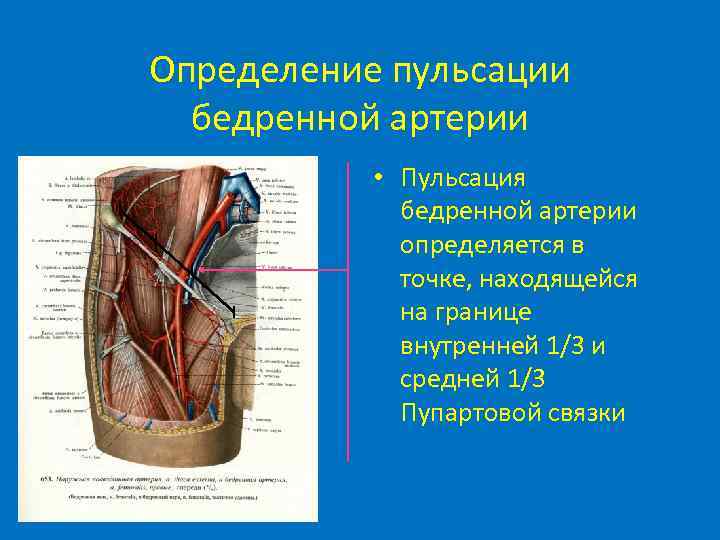 Определение пульсации бедренной артерии • Пульсация бедренной артерии определяется в точке, находящейся на границе