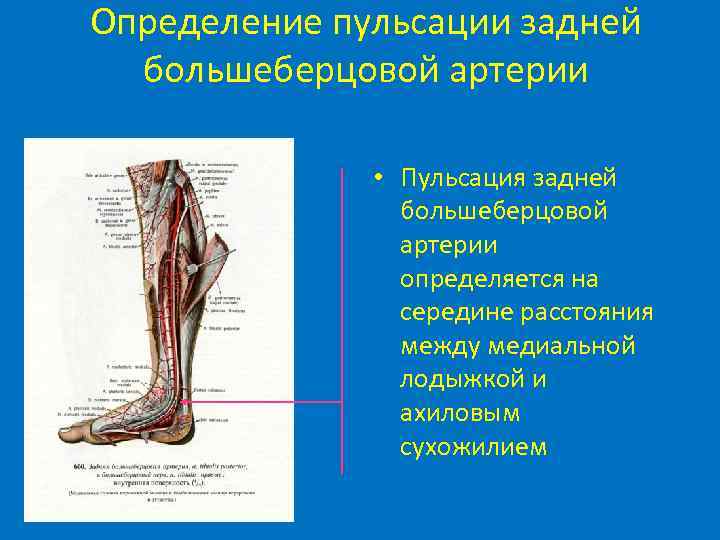 Определение пульсации задней большеберцовой артерии • Пульсация задней большеберцовой артерии определяется на середине расстояния