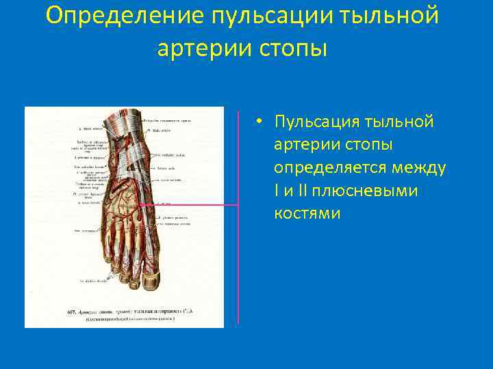 Определение пульсации тыльной артерии стопы • Пульсация тыльной артерии стопы определяется между I и