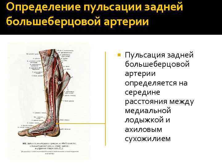 Определение пульсации задней большеберцовой артерии Пульсация задней большеберцовой артерии определяется на середине расстояния между