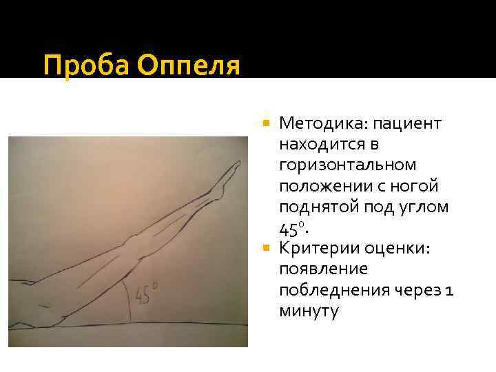 Проба Оппеля Методика: пациент находится в горизонтальном положении с ногой поднятой под углом 450.