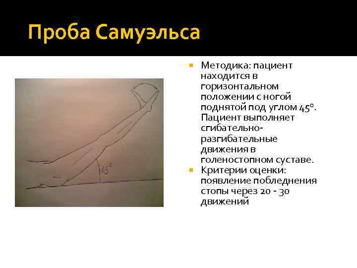 Проба Самуэльса Методика: пациент находится в горизонтальном положении с ногой поднятой под углом 450.