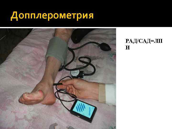 Допплерометрия РАД/САД=ЛП И 