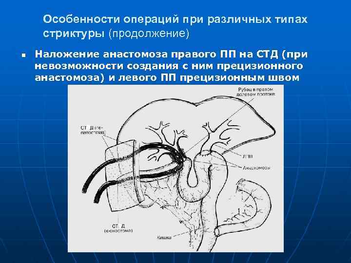 Кишечные анастомозы презентация