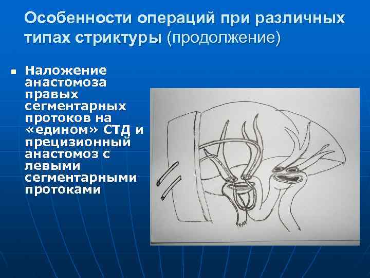 При высокой обтурации желчных протоков на первый план выступают все следующие симптомы кроме