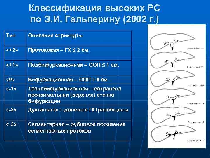Классификация высоких РС по Э. И. Гальперину (2002 г. ) Тип Описание стриктуры «+2»