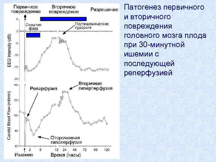 Патогенез первичного и вторичного повреждения головного мозга плода при 30 -минутной ишемии с последующей