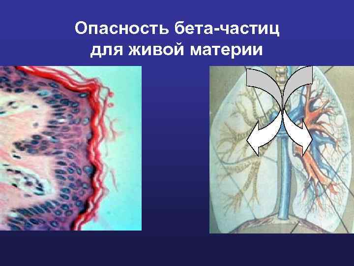 Опасность бета-частиц для живой материи 