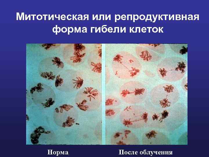 Митотическая или репродуктивная форма гибели клеток Норма После облучения 