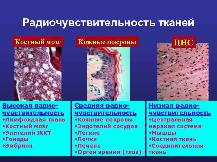 Радиочувствительность тканей Костный мозг Высокая радиочувствительность • Лимфоидная ткань • Костный мозг • Эпителий