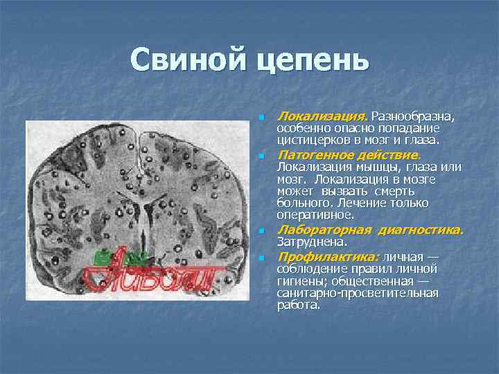 Свиной цепень n Локализация. Разнообразна, n Патогенное действие. n Лабораторная диагностика. n Профилактика: личная