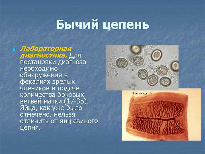 Бычий цепень n Лабораторная диагностика. Для постановки диагноза необходимо обнаружение в фекалиях зрелых члеников