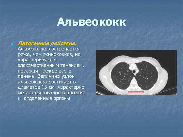 Альвеококк n Патогенное действие. Альвеококкоз встречается реже, чем эхинококкоз, но характеризуется злокачественным течением, поражая