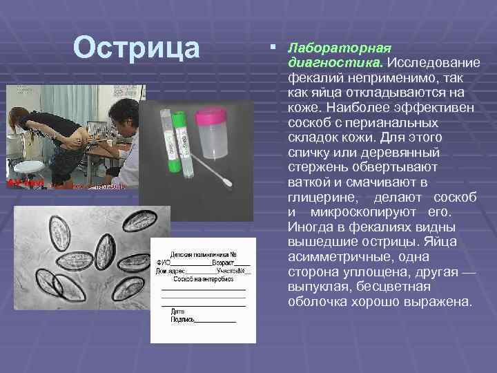 Острица § Лабораторная диагностика. Исследование фекалий неприменимо, так как яйца откладываются на коже. Наиболее