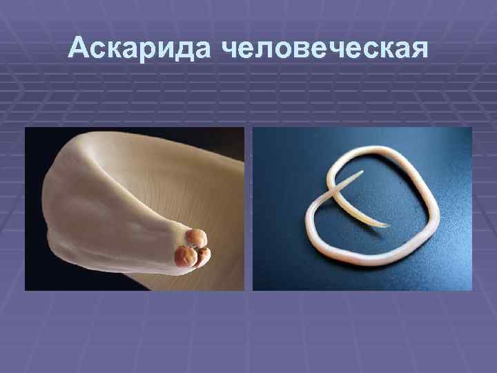 Аскарида человеческая 