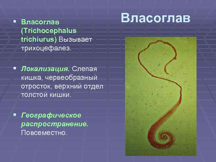§ Власоглав (Trichocephalus trichiurus) Вызывает трихоцефалез. § Локализация. Слепая кишка, червеобразный отросток, верхний отдел