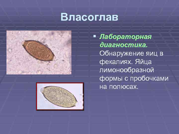 Власоглав § Лабораторная диагностика. Обнаружение яиц в фекалиях. Яйца лимонообразной формы с пробочками на