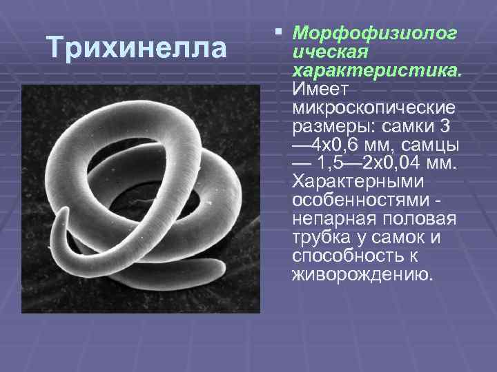 Трихинелла § Морфофизиолог ическая характеристика. Имеет микроскопические размеры: самки 3 — 4 x 0,