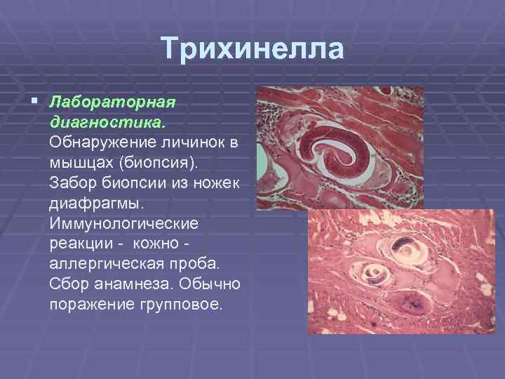 Трихинелла § Лабораторная диагностика. Обнаружение личинок в мышцах (биопсия). Забор биопсии из ножек диафрагмы.