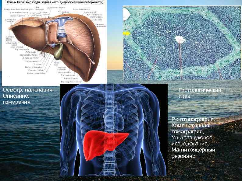 Осмотр, пальпация, Описание, измерения Гистологический срез Рентгенография Компьютерная, томография, Ультразвуковое исследование, Магнитоядерный резонанс 