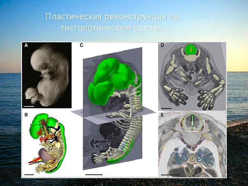 Пластическая реконструкция по гистологическим срезам 
