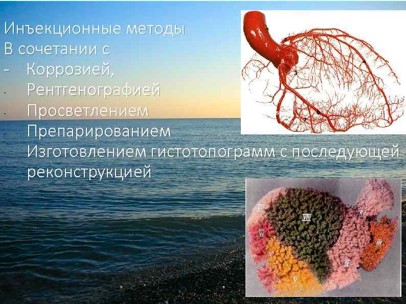 Инъекционные методы В сочетании с - Коррозией, Рентгенографией Просветлением Препарированием Изготовлением гистотопограмм с последующей