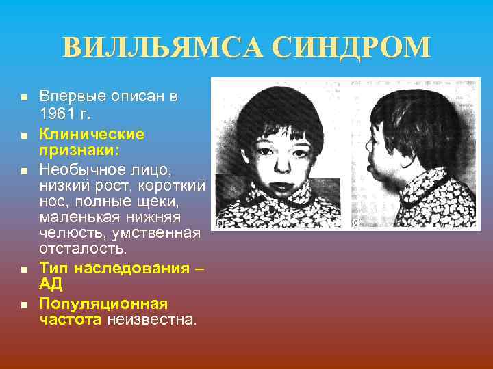 ВИЛЛЬЯМСА СИНДРОМ n n n Впервые описан в 1961 г. Клинические признаки: Необычное лицо,