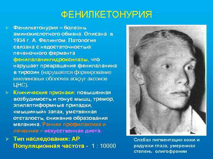 ФЕНИЛКЕТОНУРИЯ Фенилкетонурия – болезнь аминокислотного обмена. Описана в 1934 г. А. Фелингом. Патология связана