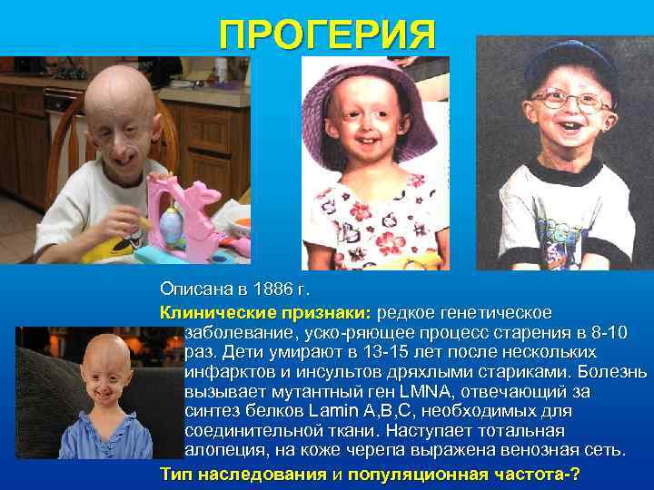 ПРОГЕРИЯ Описана в 1886 г. Клинические признаки: редкое генетическое заболевание, уско-ряющее процесс старения в
