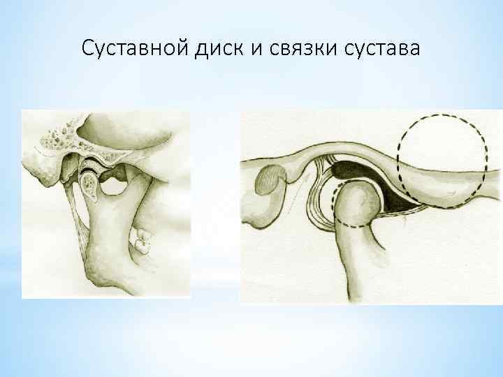 Суставной диск и связки сустава 