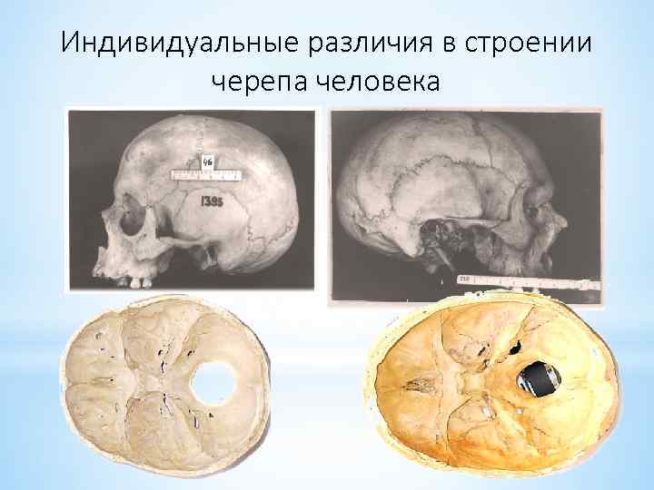 Индивидуальные различия в строении черепа человека 