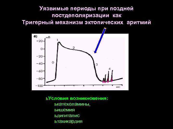 Уязвимые периоды при поздней постдеполяризации как Тригерный механизм эктопических аритмий ь Условия возникновения: ь