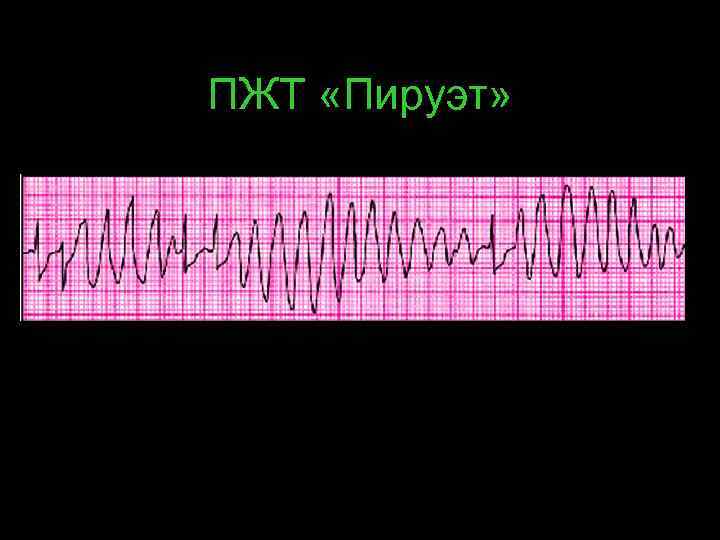 ПЖТ «Пируэт» 