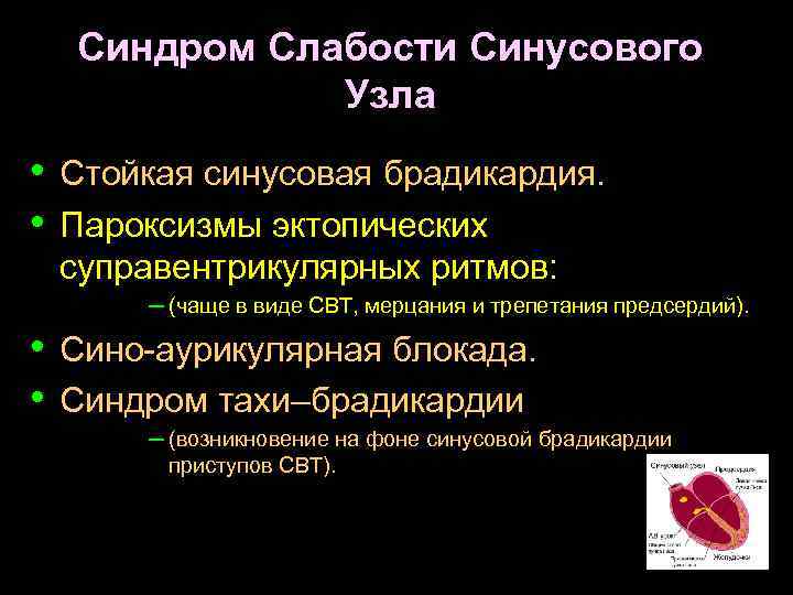 Синдром слабости синусового узла код мкб 10