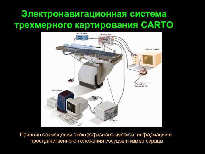 Электронавигационная система трехмерного картирования CARTO Принцип совмещения электрофизиологической информации и пространственного положения сосудов и