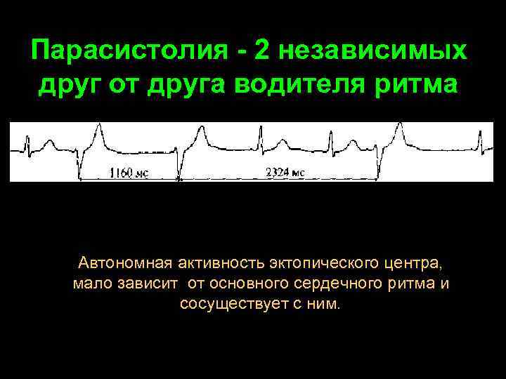 Нарушение ритма сердца презентация