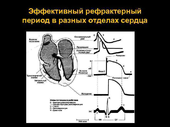 Нарушение ритма сердца презентация